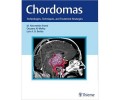 Chordomas: Technologies,Techniques, and Treatment Strategies 1st/2017